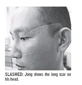 Jong shows the long scar on his head
