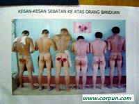 Malaysia: caned buttocks - Click to enlarge